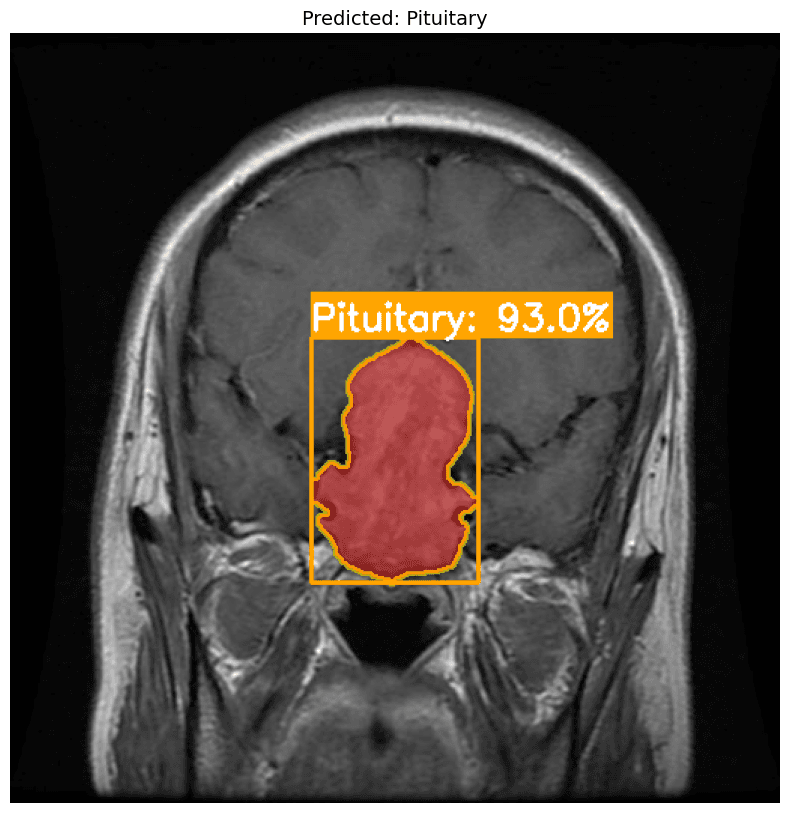 YOLOv11 AI Tumor Detection Segmentation Mask Output